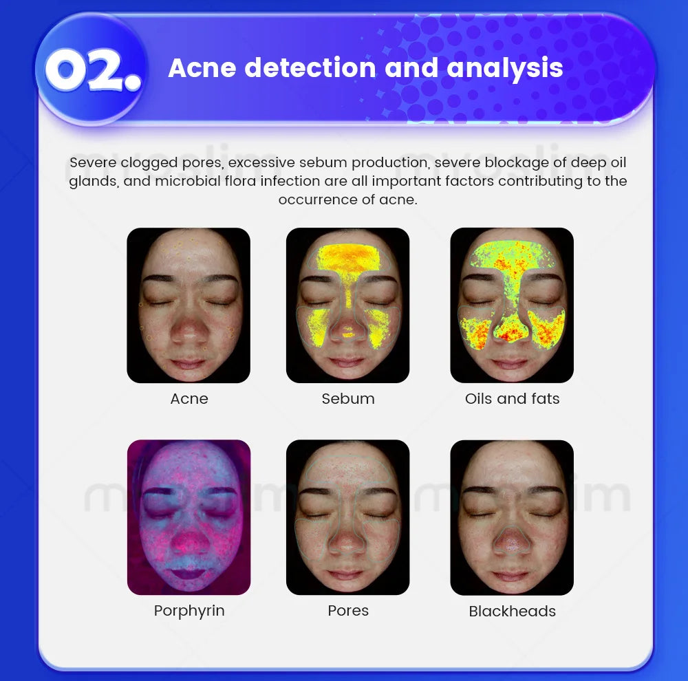 Upgraded X5 3D Ai Skin Image Analyzer High Definition Pixels Whole Facial Scanning Multi Spectrum Moisture Scalp Detection